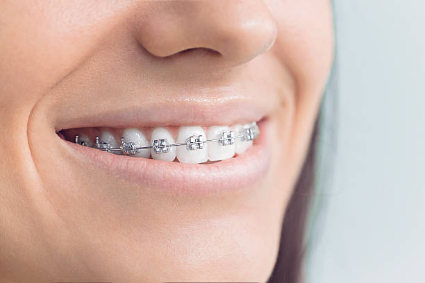 Full Mouth Reconstruction in Canterwood, WA